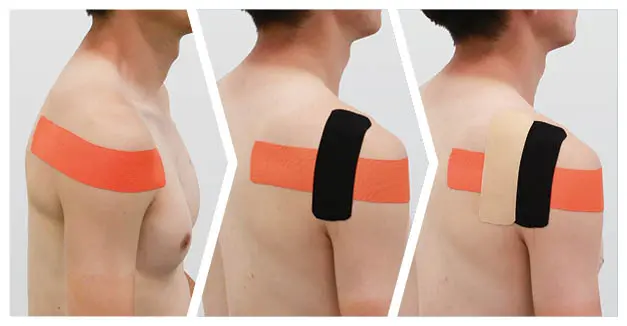usage example for Kinesiology Tape
