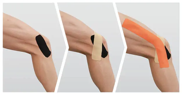 usage example for Kinesiology Tape