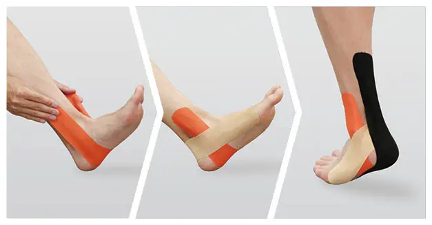 usage example for Kinesiology Tape